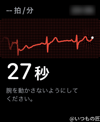 apple-watch-7-electrocardiogram | ガジェットレビューの匠 心電図アプリを使うと心電図が計測できるわけですが、専門家でもない素人が定期的に計測するかな…というのはありますね。